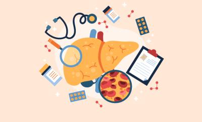 What are the symptoms of a fatty liver? | AFD Pharma